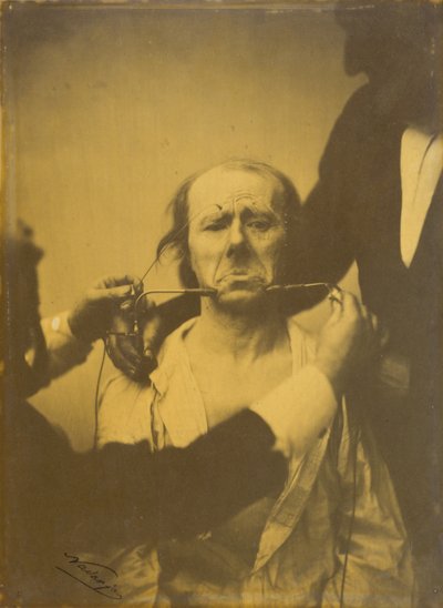 दर्द और निराशा, 1854-1856, 1862 छपी। द्वारा डचेन डी बोलोग्ने