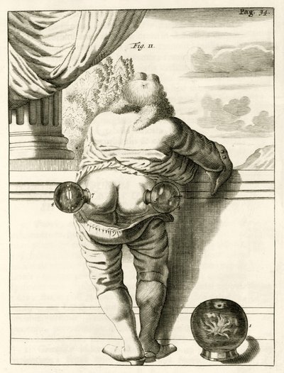 सिंघी, व्यावहारिक अभ्यास से का एक उदाहरण फ्रेडेरिक डेक्कर्स द्वारा, 1694 विधि के इलाज के लिए द्वारा डच स्कूल