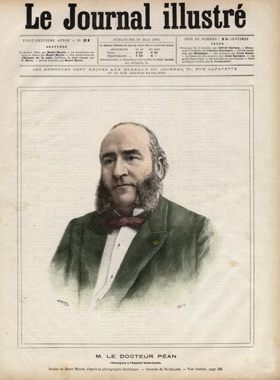 जूल्स एमिल का पोर्ट्रेट (जूल्स-एमिल) पीन (1830-1898), फ्रांसीसी सर्जन - 1892 की "द इलस्ट्रस डायरी" में नेवेलियर द्वारा उत्कीर्ण द्वारा एडोर्ड फेलिसियन यूजीन नेवलियर