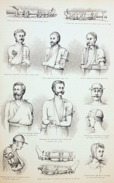 अस्थाई उपचार अस्थाई उपचार, c.1890 द्वारा अंग्रेजी स्कूल