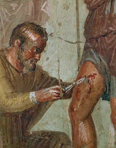  द्वारा एरिच लेसिंग