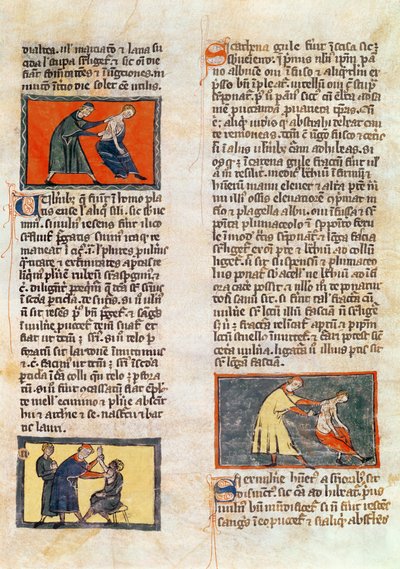 Ms H 89 fol.17r सर्जरी, रोजर डी सालर्न द्वारा &39;बुक ऑफ सर्जरी&39; के एक संस्करण से द्वारा फ्रेंच स्कूल