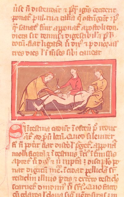 Ms H 89 fol.23 सर्जरी, रोजियर डी सालर्न द्वारा सर्जरी की पुस्तक के एक संस्करण से द्वारा फ्रेंच स्कूल