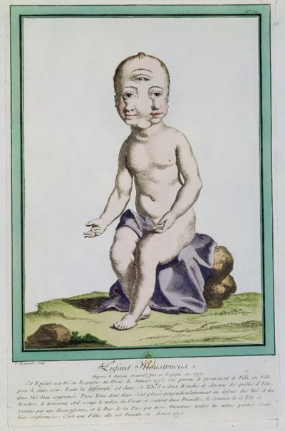पेरिस, 1775 के &39;लेस इकार्ट्स डी ला नेचर&39; से एक विकृत सिर वाला बच्चा द्वारा जिनेविव रेग्नॉल्ट डी नंगिस
