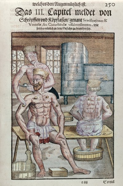 1583 में ड्रेसडेन में कलरफुल (कलर वुडब्लॉक प्रिंट) में प्रकाशित जॉर्ज बार्टिस्क (1535-1636) द्वारा ओफ्थाल्मोडौलिया से क्यूपिंग द्वारा जर्मन स्कूल