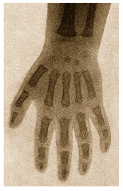 एक चिल्ड हाथ का X रे c.1890 द्वारा जर्मन स्कूल