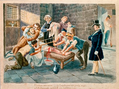 पैट्रियट और कार्बोनेरिया (कार्बोनारिज़्म) के सदस्य पिएत्रो मारोंसेली (1795-1846) मोराविया में स्पीलबर्ग के किले के प्रायश्चित में कारावास के दौरान अपने पैर के विच्छिन्न थे। 19वीं सदी के म्यूजियो डेल रिसोर्गिमेंटो, मिलानो के प्रिंट द्वारा इतालवी स्कूल