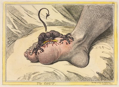 गाउट, 1799। द्वारा जेम्स गिलियरे