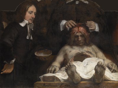 डॉ। जे डेमैन का एनाटॉमी लेसन, 1656 द्वारा रिमब्रांड वैन रिजन
