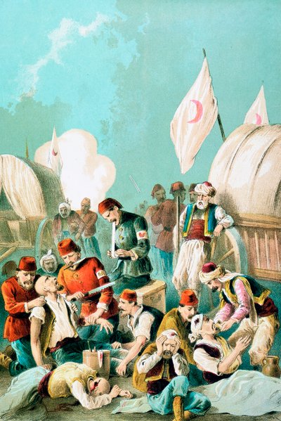 बिना बेहोश किए हाथ काटा जाना, रूस-तुर्की युद्ध, 1877 द्वारा अज्ञात