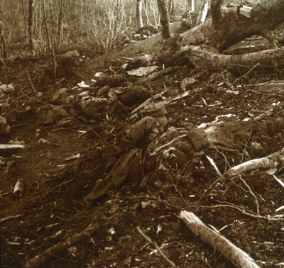 निकाय, लेस gesपारेज, उत्तरी फ्रांस, 1915। द्वारा अज्ञात