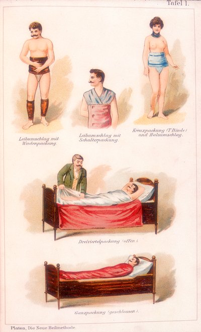 हाइड्रोथेरेपी उपचार, c1902 द्वारा अज्ञात