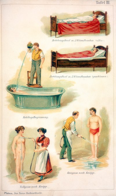 हाइड्रोथेरेपी उपचार, c1902 द्वारा अज्ञात