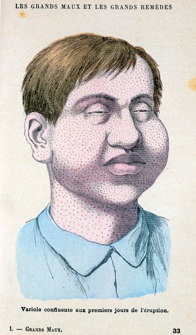 चेचक का शिकार, c1890 द्वारा अज्ञात