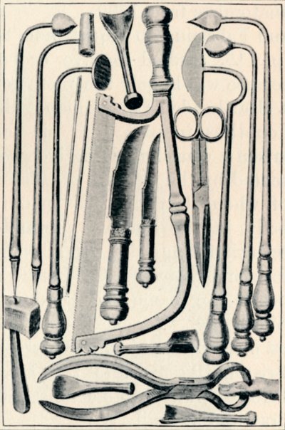 सर्जिकल उपकरण, 1639, 1903 द्वारा अज्ञात