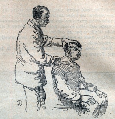 ज्यूडिशियल एंथ्रोपोमेट्री या बर्टिलोनेज, अल्फोंस बर्टिलन की विधि (1853-1914): कान माप - "ला साइंस फ़्रैन्काइज़" में उत्कीर्णन " द्वारा अज्ञात कलाकार