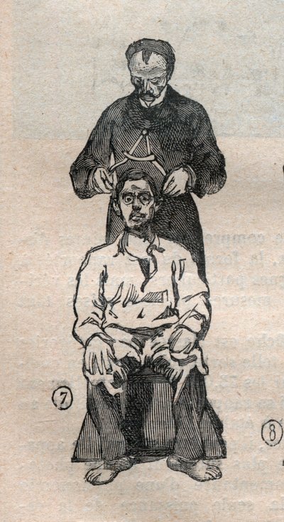 न्यायिक मानवमिति या बर्टिलोनेज, अल्फोंस बर्टिलन की विधि (1853-1914): खोपड़ी के अनुप्रस्थ व्यास का मापन - उत्कीर्णन "" ला साइंस फ़्रैन्काइज़ "में द्वारा अज्ञात कलाकार