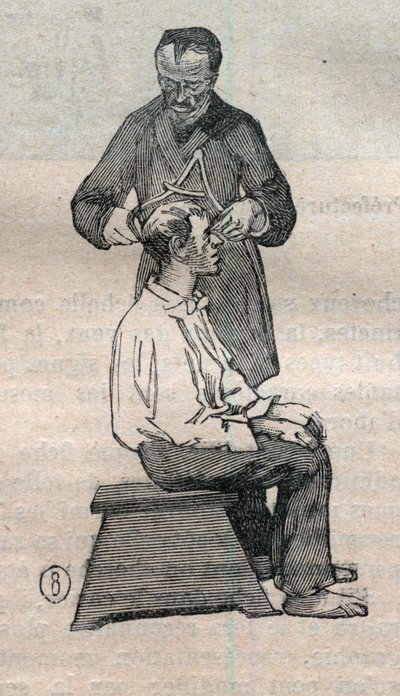 न्यायिक मानवमिति या बर्टिलोनेज, अल्फोंस बर्टिलन की विधि (1853-1914): खोपड़ी के अनुप्रस्थ व्यास का मापन - उत्कीर्णन "" ला साइंस फ़्रैन्काइज़ "में द्वारा अज्ञात कलाकार