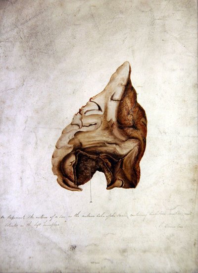 मस्तिष्क I का अध्ययन, c.1850 (कागज पर जल रंग) द्वारा विलियम प्रेमी