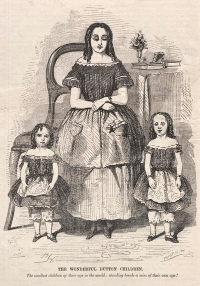 द वंडरफुल डटन बच्चे, 1859। द्वारा विंसलो होमर