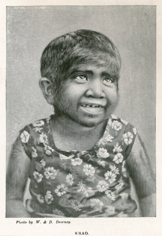 क्राउ, द मिसिंग लिंक, 1887 में एक्वेरियम, वेस्टमिंस्टर, लंदन में प्रदर्शित किया गया द्वारा अंग्रेजी फोटोग्राफर
